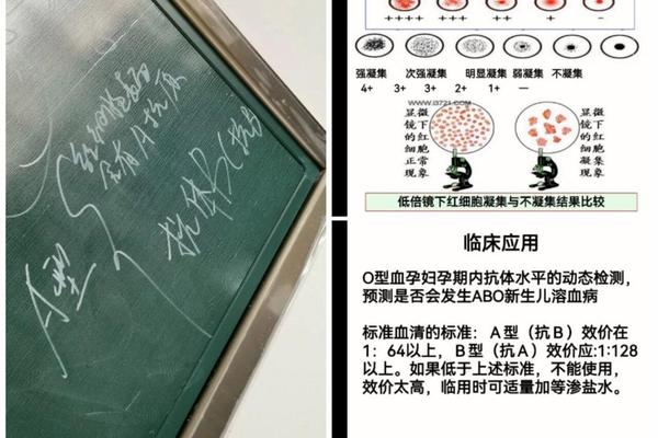 血型测定抗A凝集为什么血型 抗a抗b都不凝集是什么血型