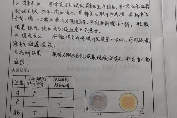 血型抗a试验结果;血型抗筛是什么意思