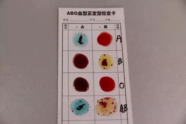 lgg血型抗a超标-o型血抗体效价1比256