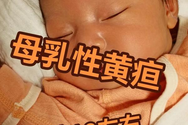 母亲a血型容易黄疸、黄疸什么血型厉害 母亲a血型容易黄疸、黄疸什么血型厉害