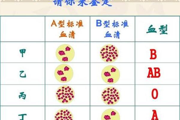 血型a和b抗原,ab都凝集是什么血型