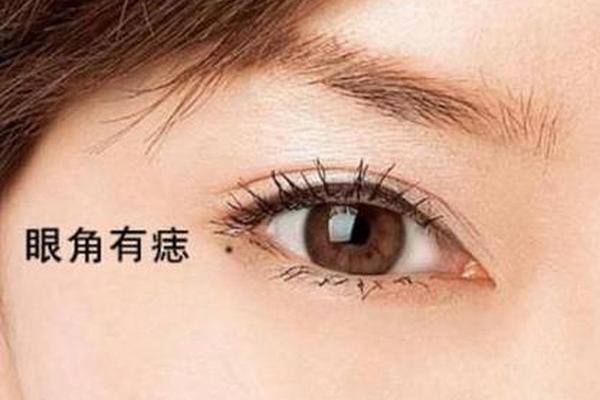 女人痣相泪痣—女人泪痣图解大全