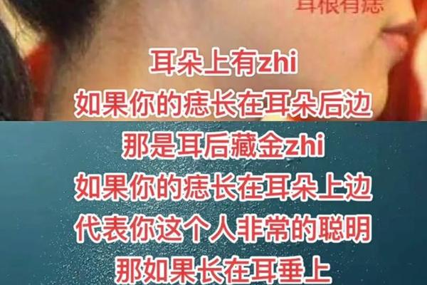 女性耳部痣相图解-痣相,女人耳朵痣图解对照表 女性耳部痣相图解-痣相,女人耳朵痣图解对照表