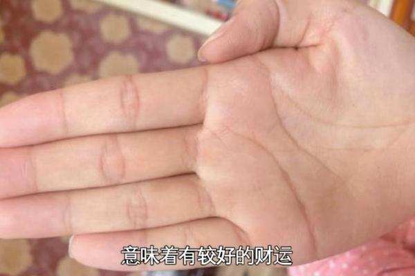 元宝纹掌相有个痣好不好,手掌元宝纹和三角纹怎样的
