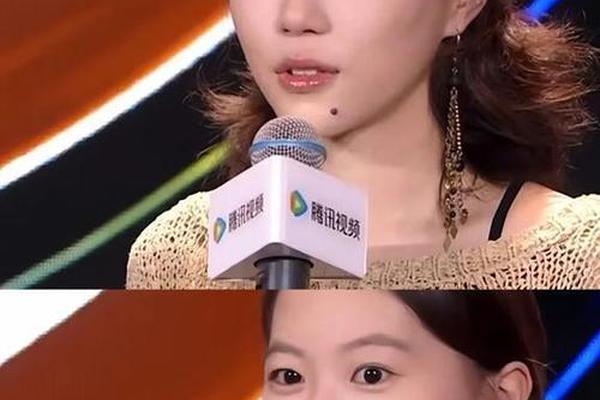 窦靖童下巴痣相、女人下巴痣相图解大全