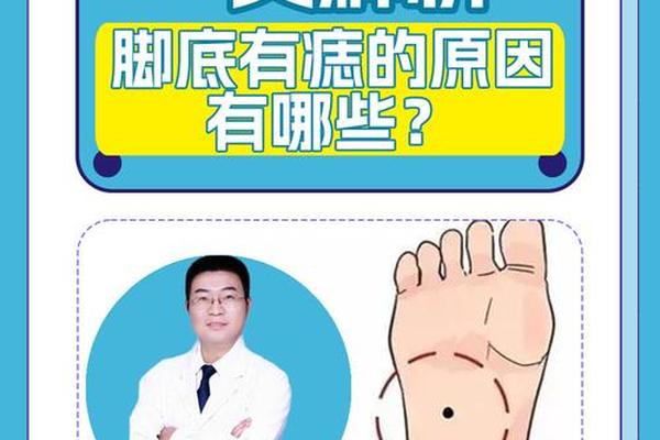脚底痣相的人命运_手掌痣相图解