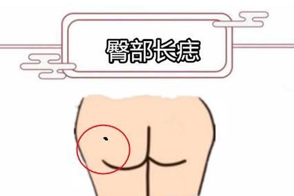 阴边痣相、外阴有痣是什么意思