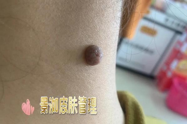麻衣神相脖子后面有痣_女人痣相图解
