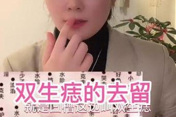 痣相双生是啥意思-双生痣是好还是坏