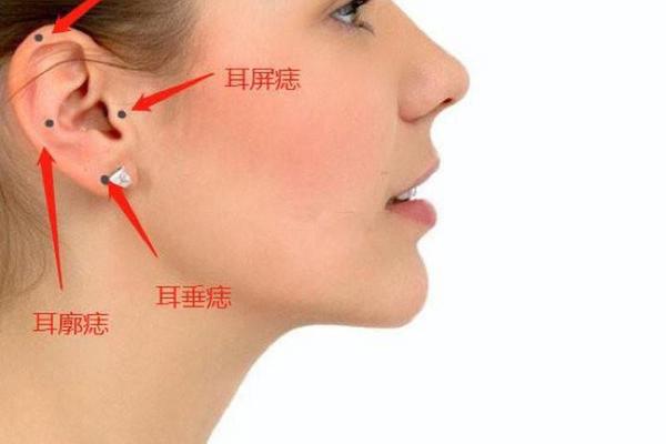 耳朵耳边痣相(耳朵痣相图解)