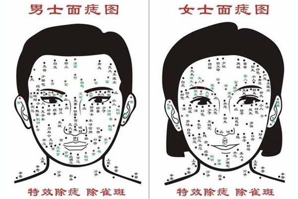 痣相运程_面部长痣全部图