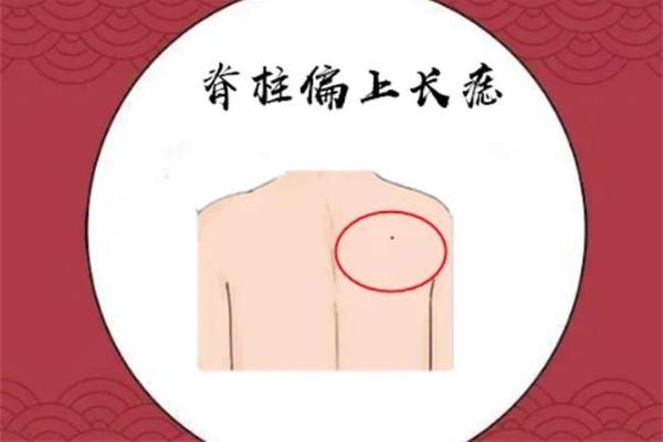 男人背部痣相全图及解释(后背有痣命苦)