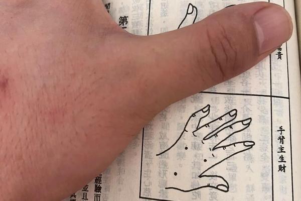拍照测手痣相app 识别痣位置的app