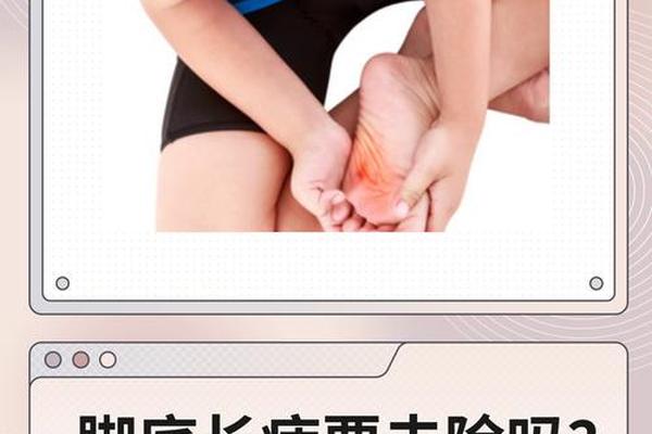 痣相长在脚底下 脚踵长痣富贵图解