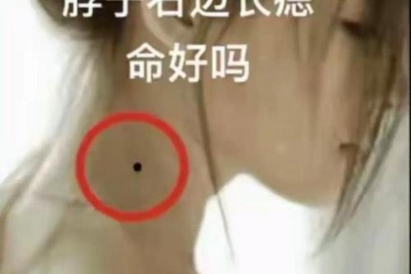 痣相脖子后 脖子后痣相图解大全