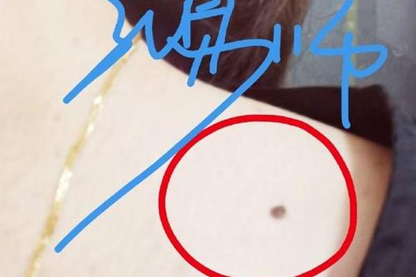 痣相右肩有痣—右肩膀有痣的位置与命运