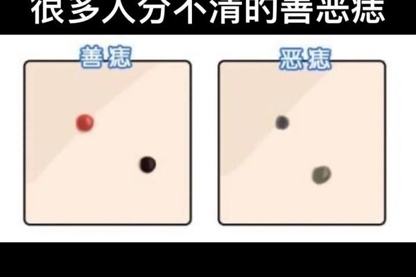 痣相祸福对照 怎么看痣的善恶