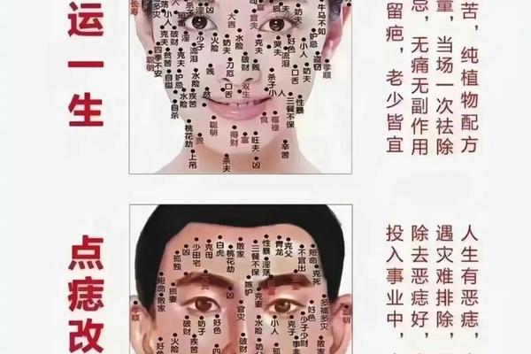 脸上痣相解析,痣相图解10大福痣