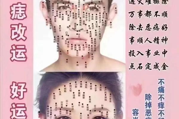 桂林哪里有看痣相(桂林点痣哪家医院最好)