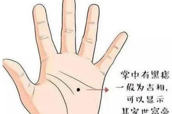 痣相大贵的意思—手掌痣相图解