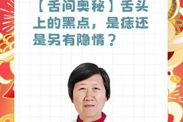 口舌痣相的代表含义,口舌奴什么意思