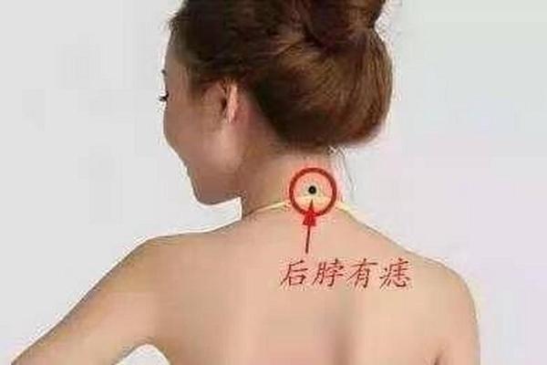 女人后背痣相大全—女人后背有痣好吗