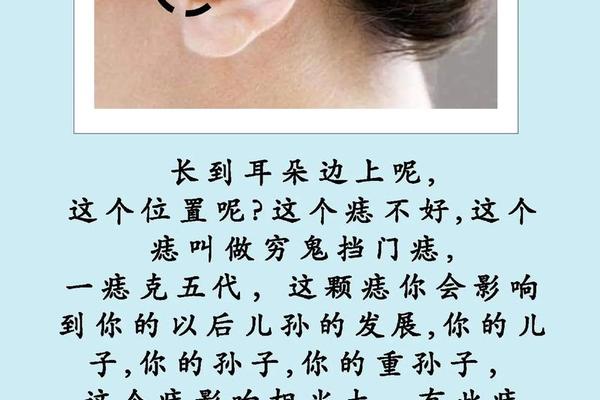 女人左耳朵痣相最准图_女人左耳轮廓有痣图解 女人左耳朵痣相最准图_女人左耳轮廓有痣图解