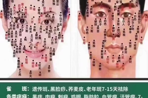 邯郸痣相,邯郸点痣哪个医院好