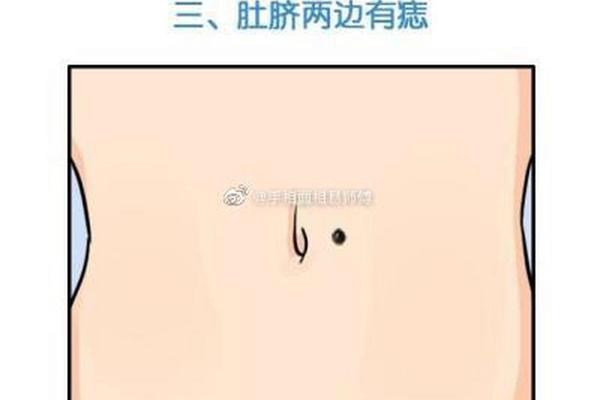 肚脐眼有痣相 肚脐眼里长痣