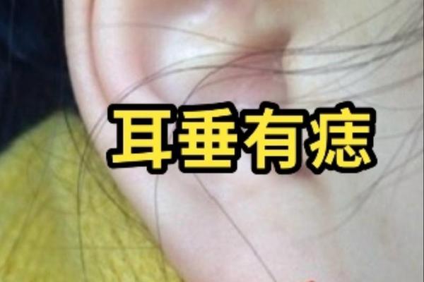 痣相脖子耳朵下方、耳朵下方脖子侧边长痣