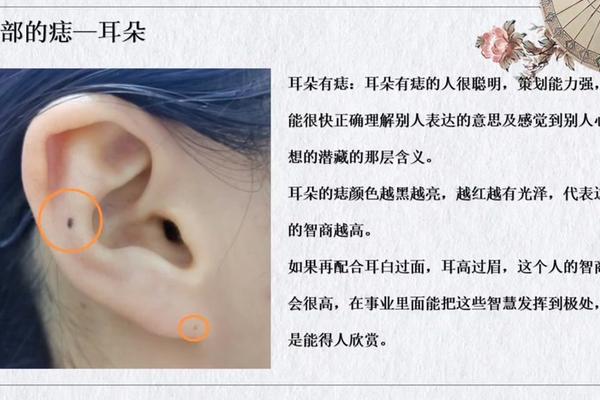 耳朵相痣图解大全_耳朵上的痣命相图解