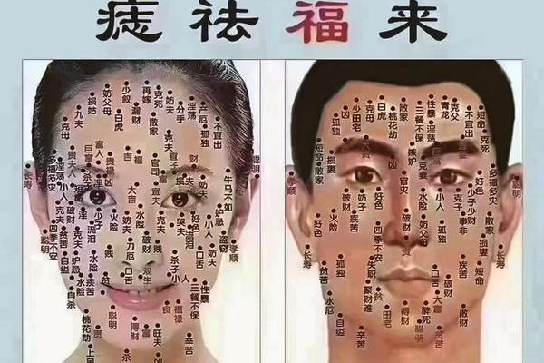 点痣脱相玄学_点痣真的能改运吗