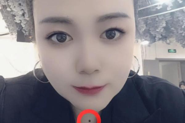 手上的痣相代表什么-脖子上有痣代表什么