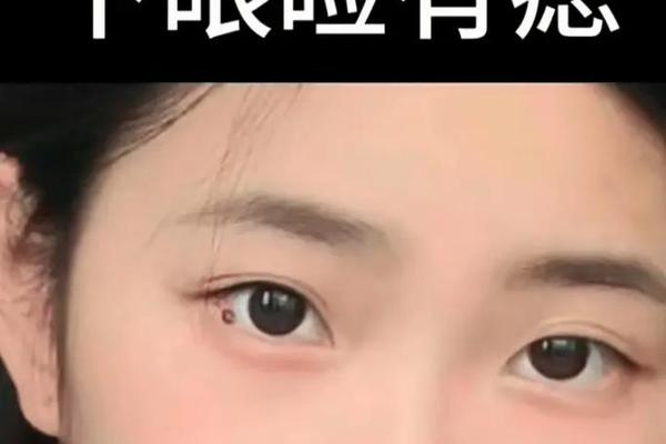 右眼下角痣相;右眼下角的痣叫什么痣