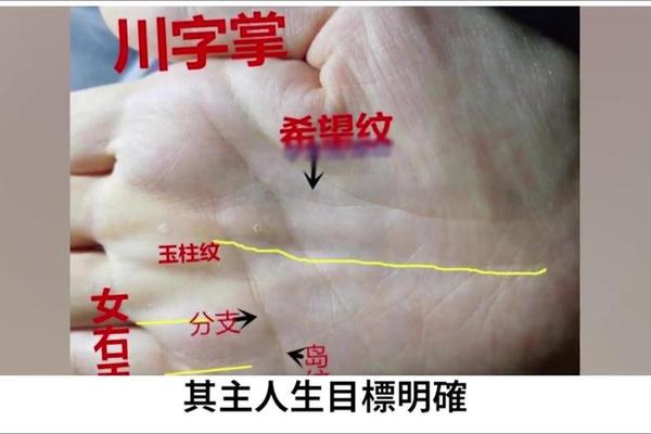 女生右手痣相,女生右手掌上的痣图解
