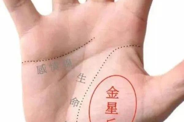 手相金星丘痣相—右手金星丘有痣