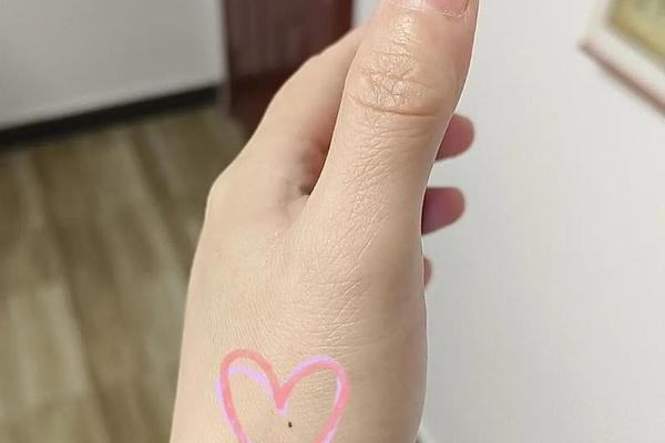 男人左手背痣相最准图、男人左手痣代表什么