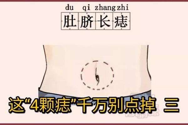 长在肚子的痣相—肚子上的痣图解 长在肚子的痣相—肚子上的痣图解
