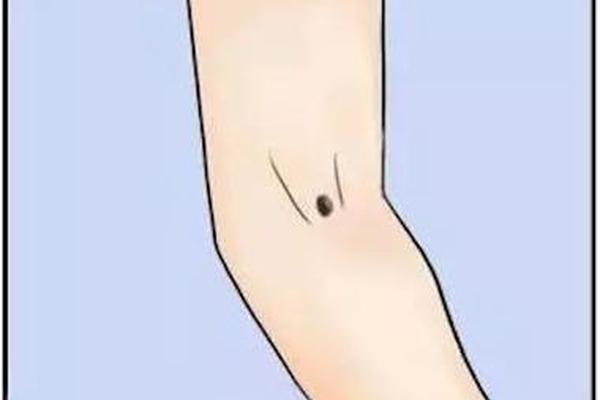 女人手肘有痣的痣相含义;左胳膊肘下面有痣