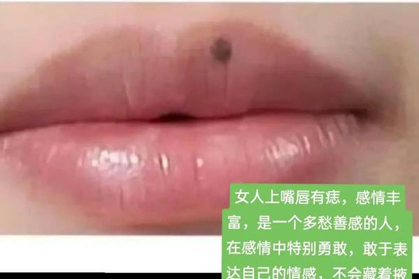 嘴唇上有痣的人相 嘴巴有痣的女人