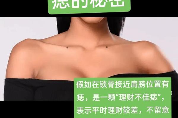 锁骨周围痣相(锁骨周围的痣图解)