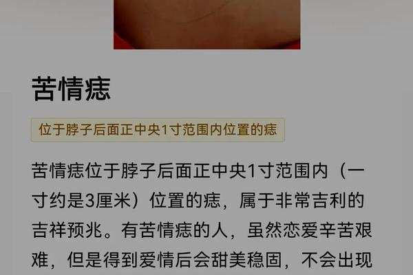 宣子痣相什么意思、相学上瘊子和痣的区别