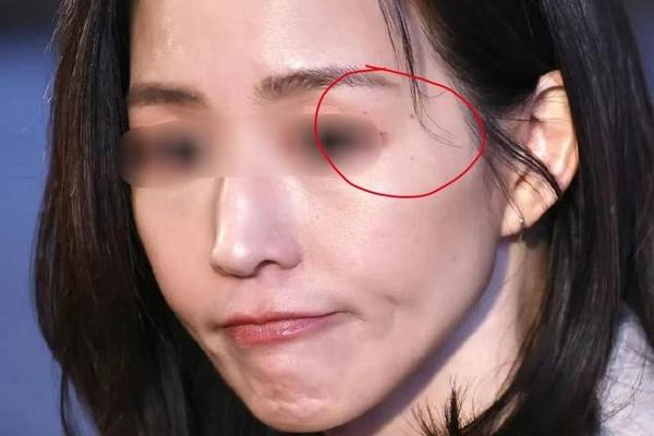 眉尾痣相女—女人没有眉尾有什么说法