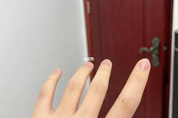 左手食指的痣痣相 左手食指上突然长个痣