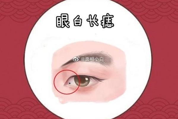 水镜神相眼白有痣好不好_眼白长痣的女人好不好
