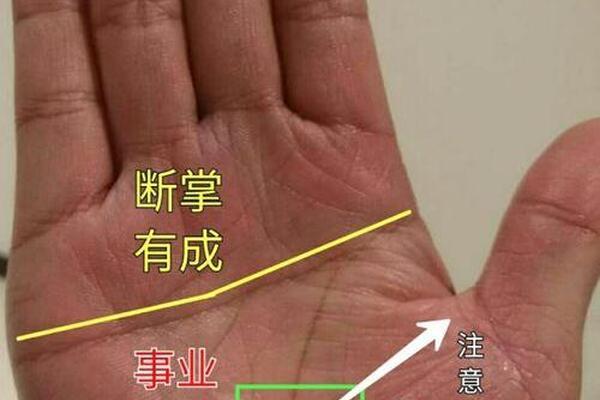 痣相不好手相好的,哪种手相命不好
