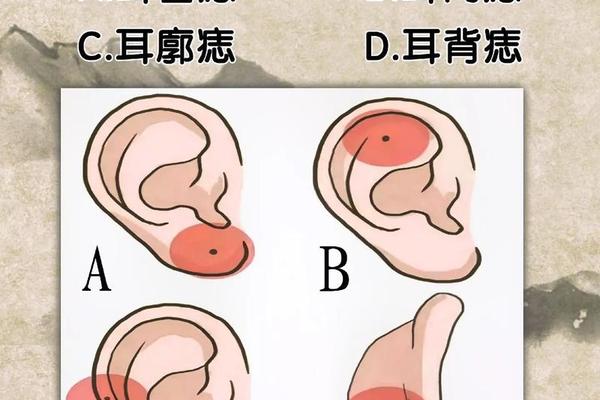 人耳朵长痣富贵相 长痣的位置和命运