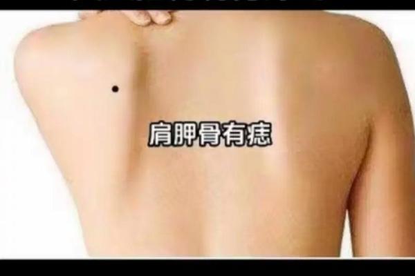 女孩子背部痣相;女人后背有痣好吗