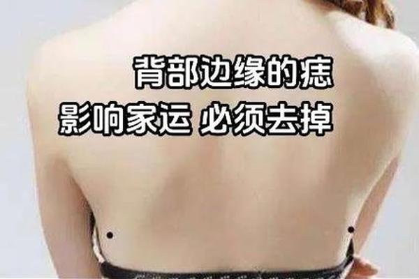后背痣相的视频 男人后背痣相最准图