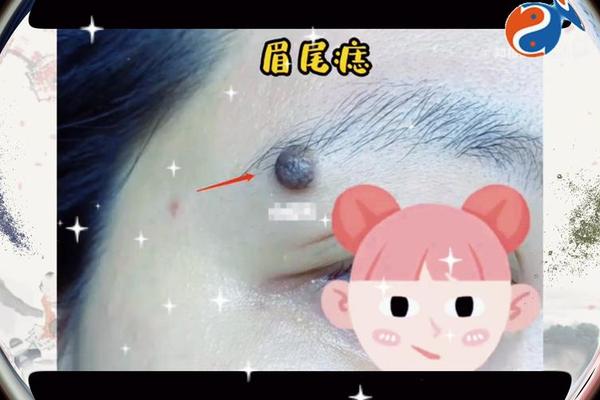 眉毛尾有痣相 左边眉毛尾有痣好不好